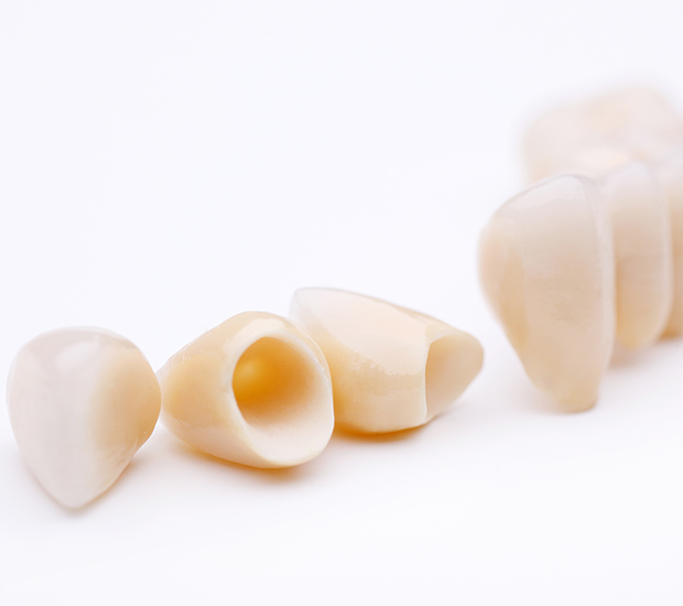 Morton Dental Crowns and Dental Bridges
