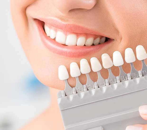 Morton Dental Veneers and Dental Laminates