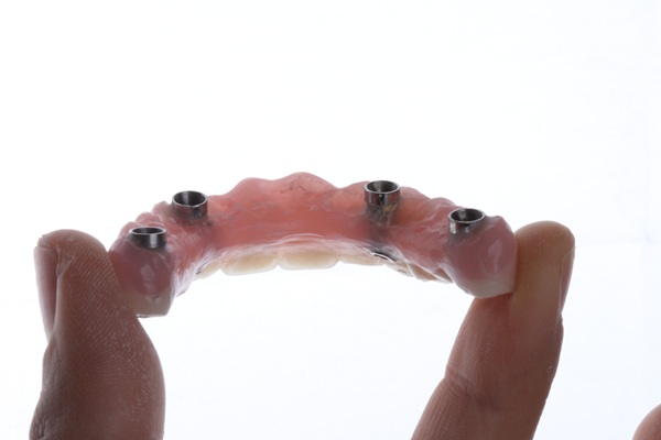 Implant Retained Dentures For Better Chewing Function