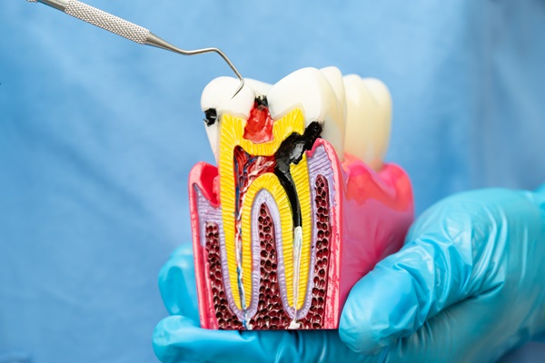 Signs You May Need A Root Canal: When To See A Dentist